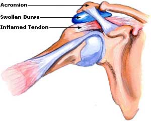 Leg Joint Pain Treatment