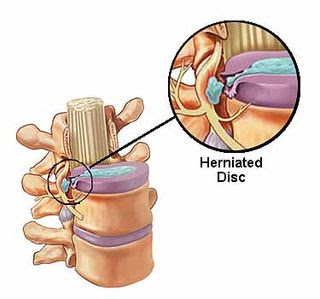 Leg Joint Pain Treatment