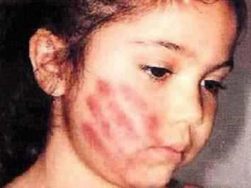 Pictures Of Abused Women And Children