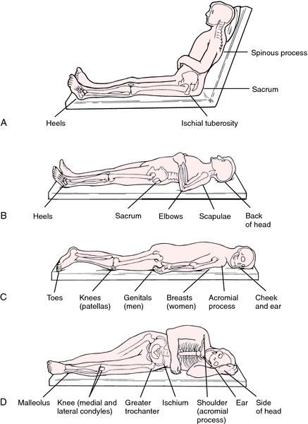 Pressure Ulcer Prevention