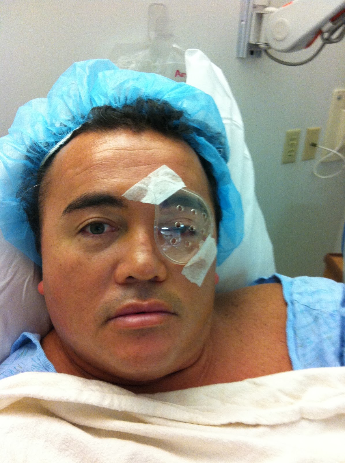 Pterygium Eye Surgery Recovery