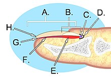 Pterygium Inversum Unguis Toenail