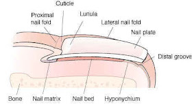 Pterygium Inversum Unguis Toenail