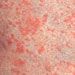 Types Of Skin Rashes In Adults