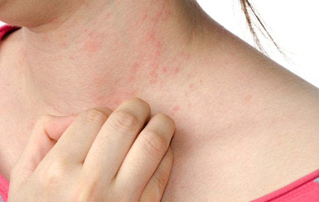 Types Of Skin Rashes On Back