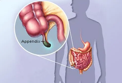 Where Are Your Appendix Located Diagram