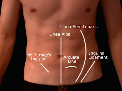 Where Are Your Appendix Located Diagram