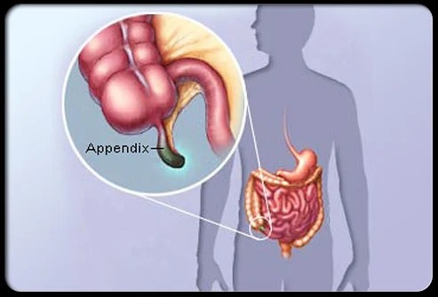 Where Are Your Appendix Located In The Human Body