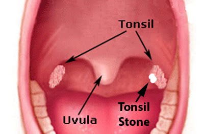 Where Are Your Tonsils Located Diagram