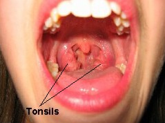 Where Are Your Tonsils Located Diagram